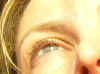 high eye.jpg (73916 bytes)